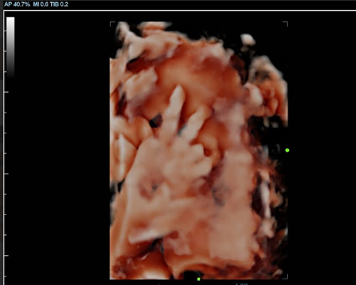 Bonding Scan and Heartbeat Bear Bundle Near Huddersfield