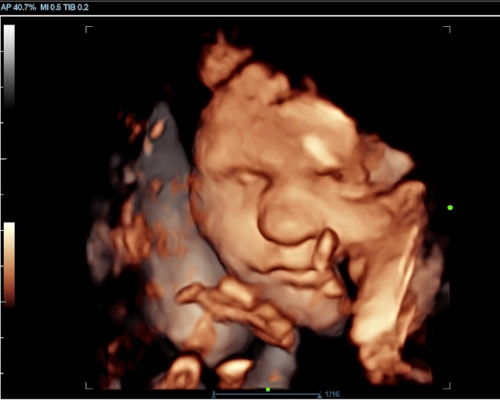 Bonding Scan Near Huddersfield