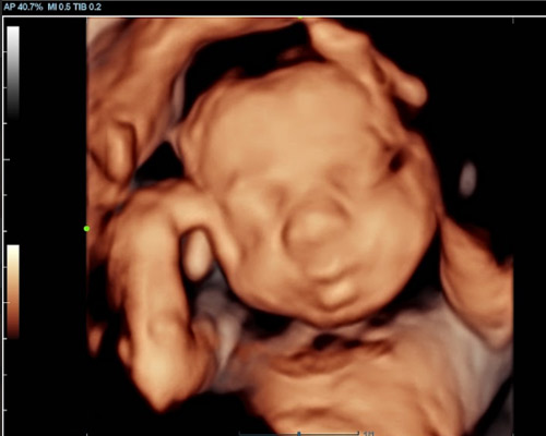 Bonding Scan Near Huddersfield