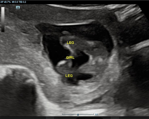 Gender Scan Near Worksop
