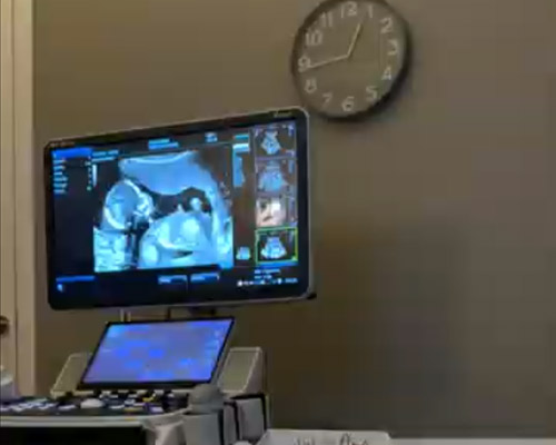 Reassurance Scan in Wakefield