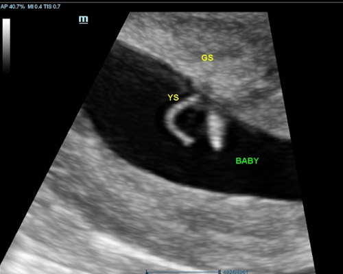 Reassurance Scan in Wakefield