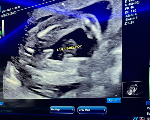 Ultrasound Scans Near Huddersfield