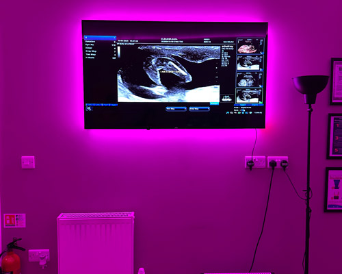 Ultrasound Scan in Wakefield