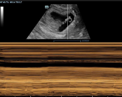 Reassurance Scan Near Huddersfield